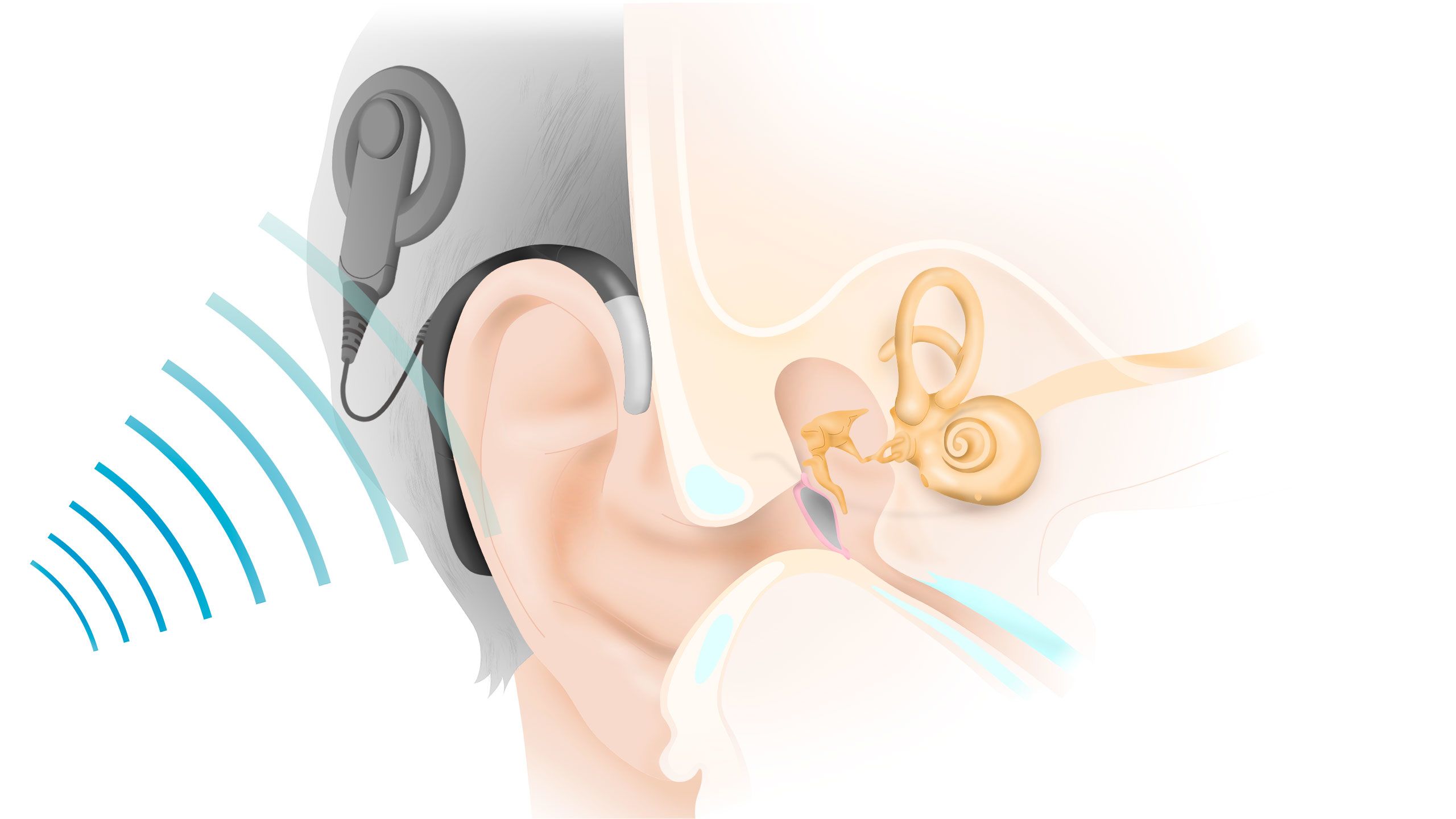 Sounds waves radiate towards the ear.