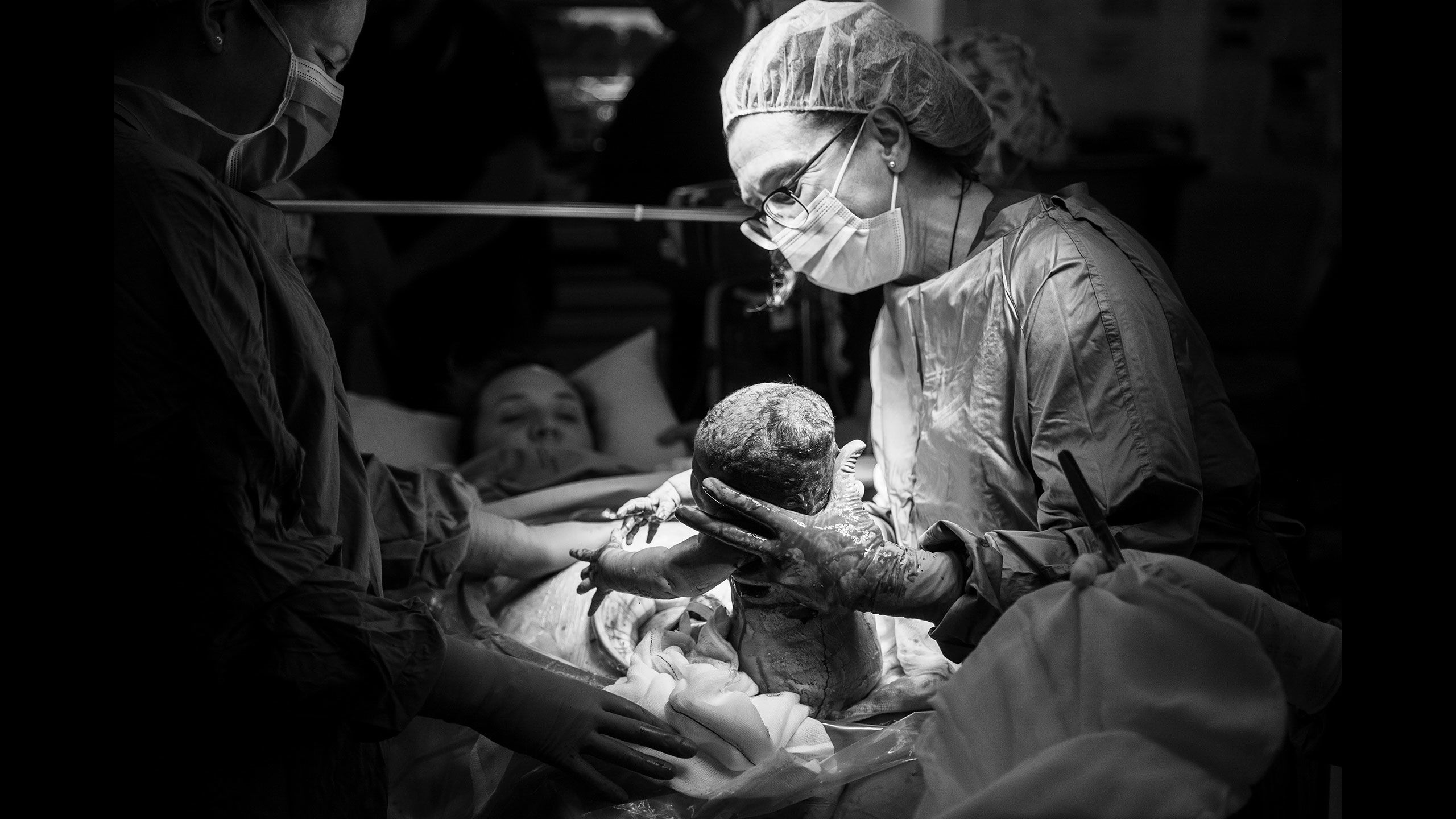 Hazel is born, being cradled in the surgeon's hands. In teh background, Jessica lies with head slightly raised to see Hazel for the first time.