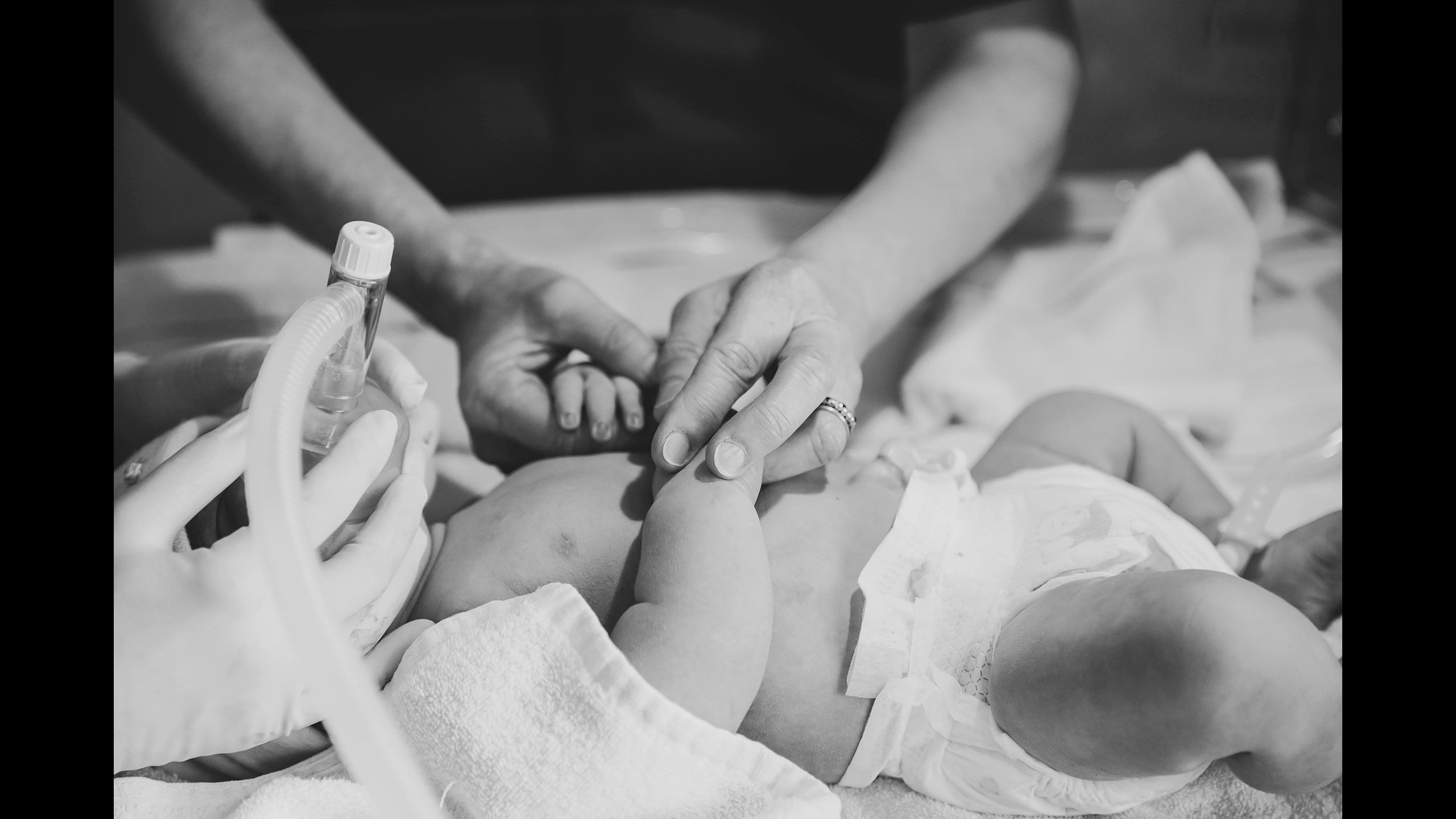 Baby Hazel is taken away and given post-birth care. She lies with caring hands supplying her with oxygen.