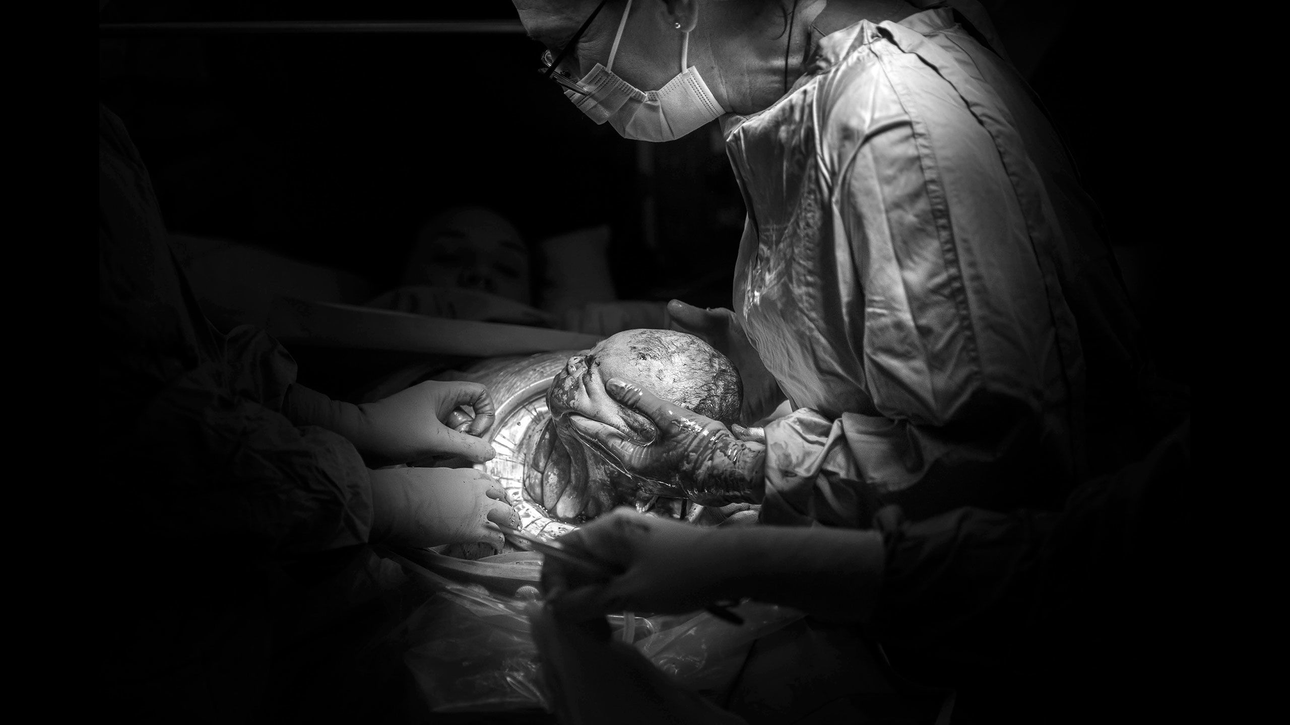 The surgeon starts to pull the Hazel's head out stretching the neck as she pulls.