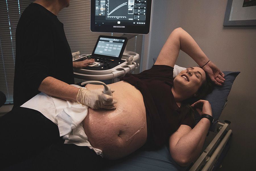 Jessica lies sideways on a hospital bed while having an ultrasound scan.