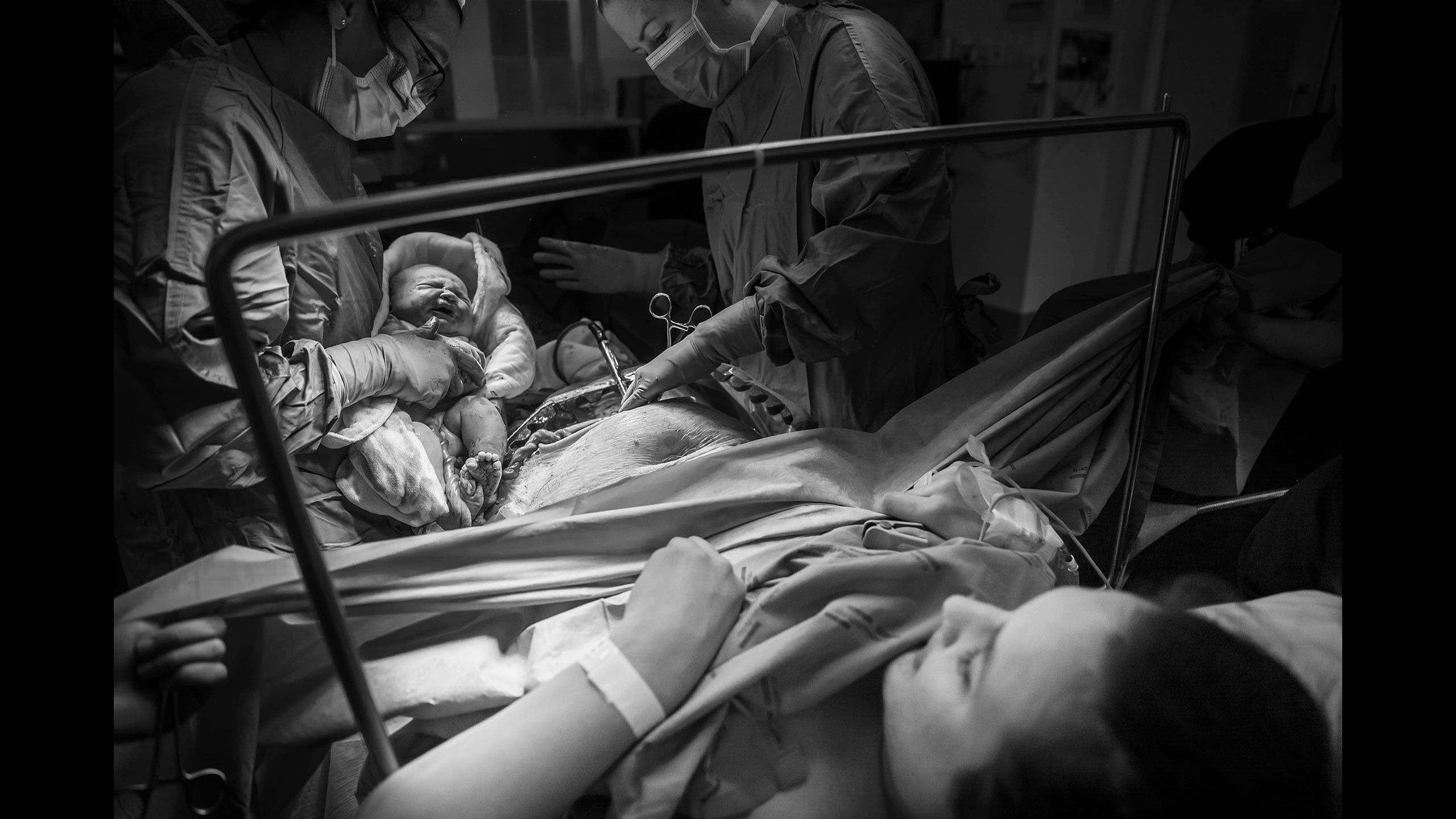 Looking for the other direction, Jessica is looking down at Hazel, who has been swaddles in cloth. You can see Jessica's belly with the surgical incision and umbilical chord ready to be cut.