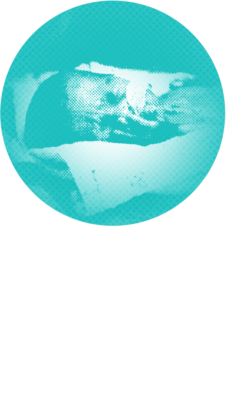 Posterised image of a premature baby.