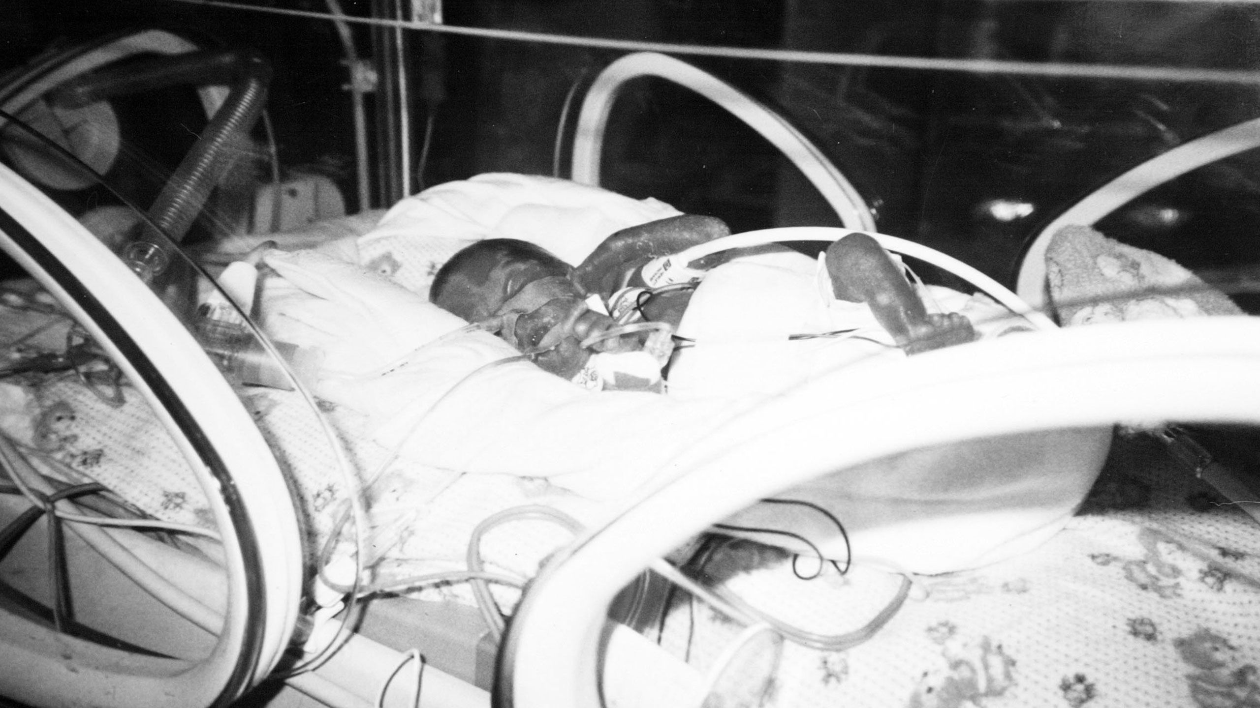 Premature Saul in his incubator.