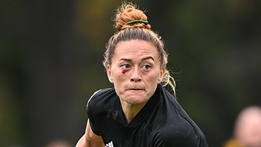 Niall Williams with a cut under her eye