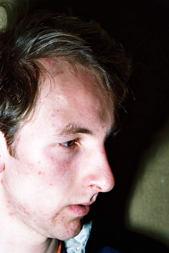 David Bain had a number of bruises on his head after the shootings. David Bain had a number of bruises on his head after the shootings.